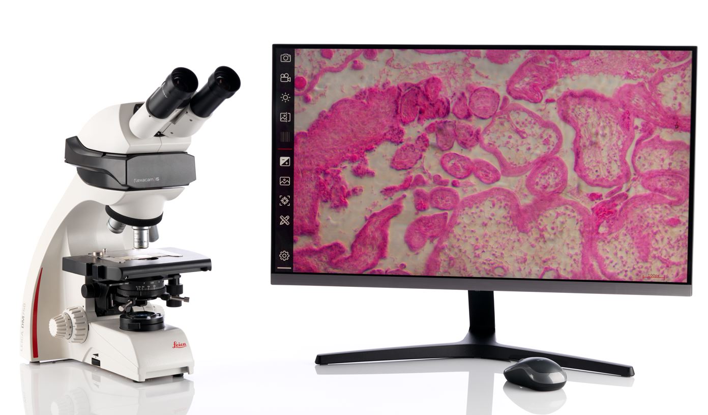 Leica Flexacam i5 Compound Microscope Camera – Microscope Central