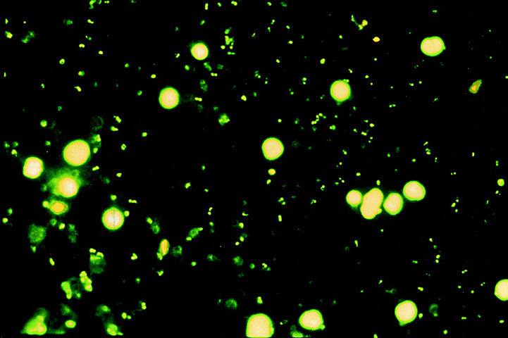 Optika B-290 LED Fluorescence Microscope