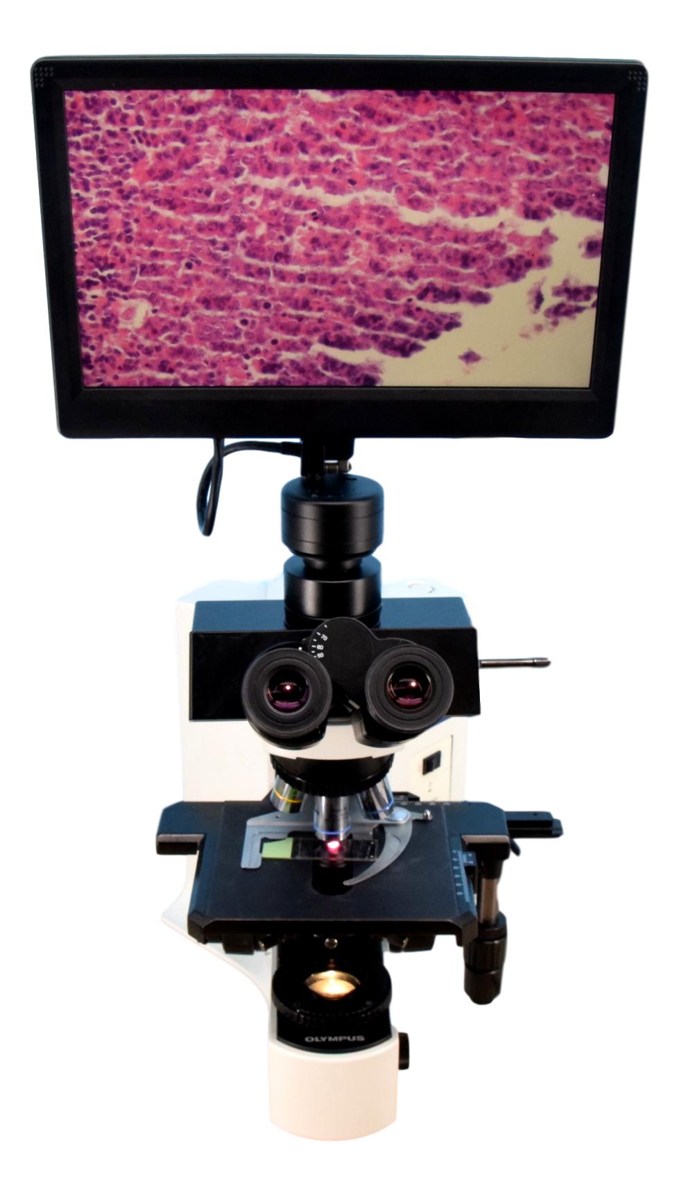 Olympus BX41 HD Digital Microscope